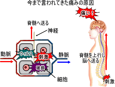 今までの言われてきた痛みの仕組み