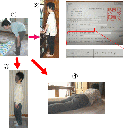 パーキンソン病改善事例1