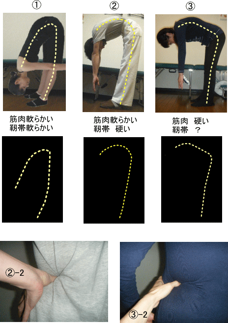 体の柔軟性と筋肉 痛みの専門院 東京 日本橋