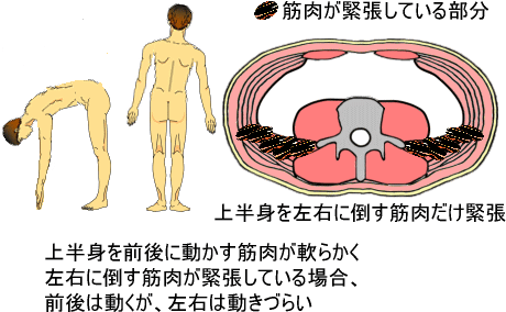 体の柔軟性と筋肉 痛みの専門院 東京 日本橋