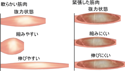 筋肉の緊張の種類 痛みの専門院 東京 日本橋