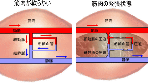 筋肉の緊張の種類 痛みの専門院 東京 日本橋